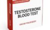 Testosterone Blood Test Guide for Residents of York