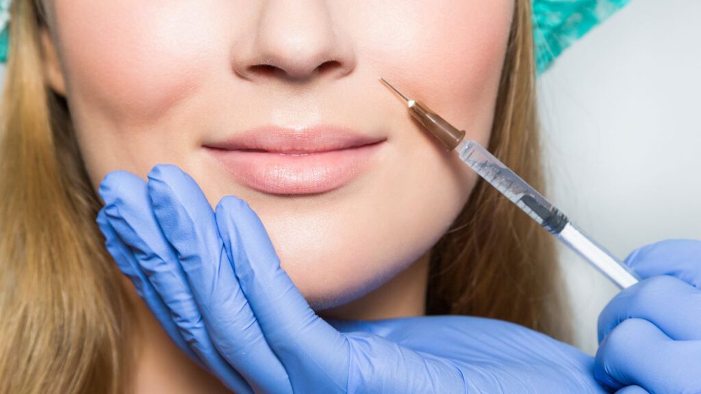 Lip Filler Simulation: Envision Your Ideal Appearance!